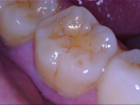 2MP 1-500X Otoskop/Mikroskop - NYHED