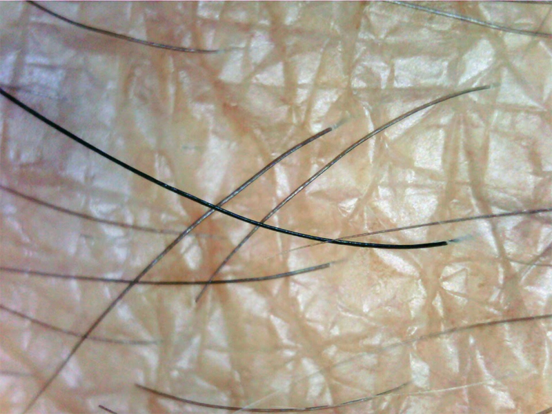 2MP 1-500X Otoskop/Mikroskop - NYHED