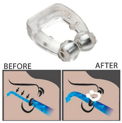 SnoreStopper næseklemme, ny version