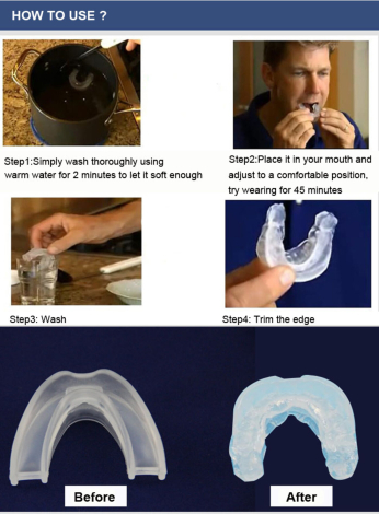 SnoreStopper Bideskinne